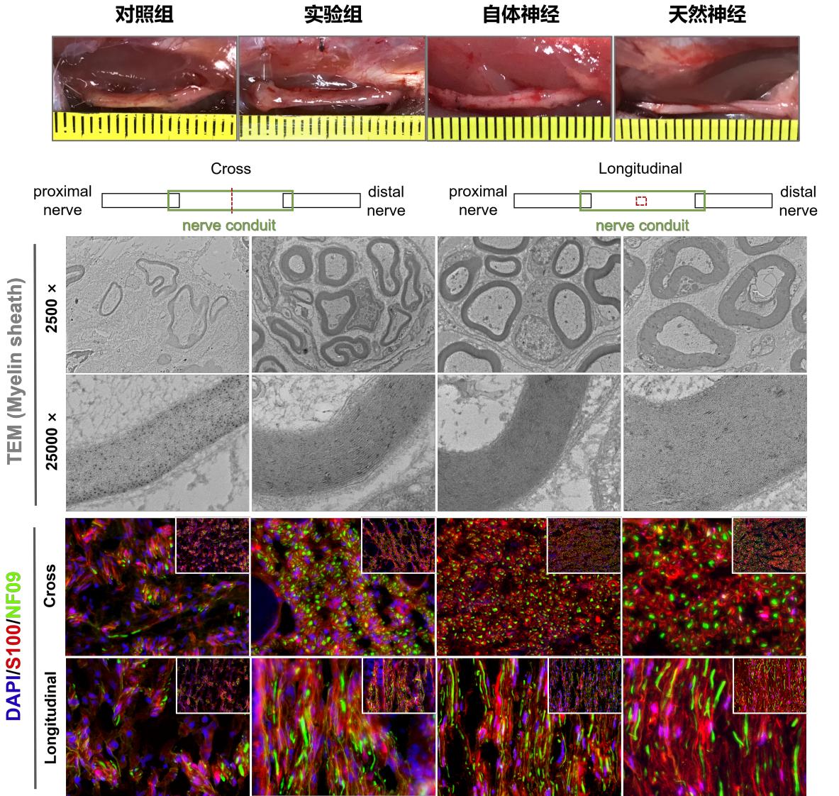 仿生可降解人工神经导管